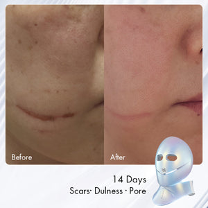 Chouohc Radiance LED Mask