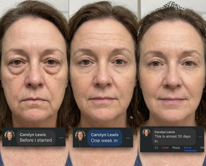 Chouohc Morpho Carver